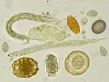 Microscopio muestra huevos y larvas de lombrices en perros. Se observan diferentes formas y tamaños de huevos, algunos con embriones.