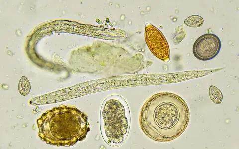 Microscopio muestra huevos y larvas de lombrices en perros. Se observan diferentes formas y tamaños de huevos, algunos con embriones.