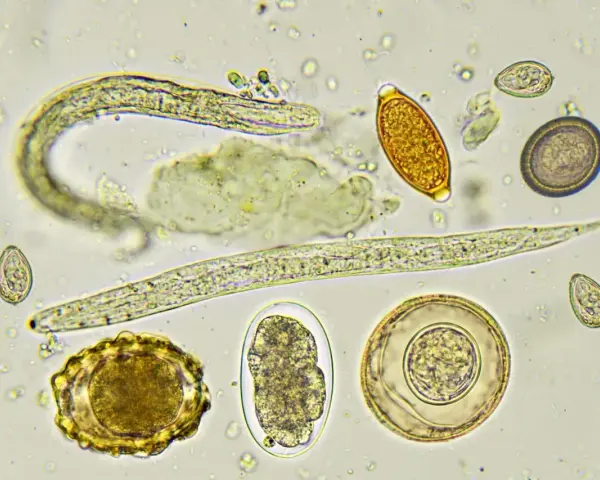 Microscopio muestra huevos y larvas de lombrices en perros. Se observan diferentes formas y tamaños de huevos, algunos con embriones.